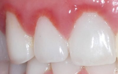 I Don’t Feel Like Brushing My Teeth