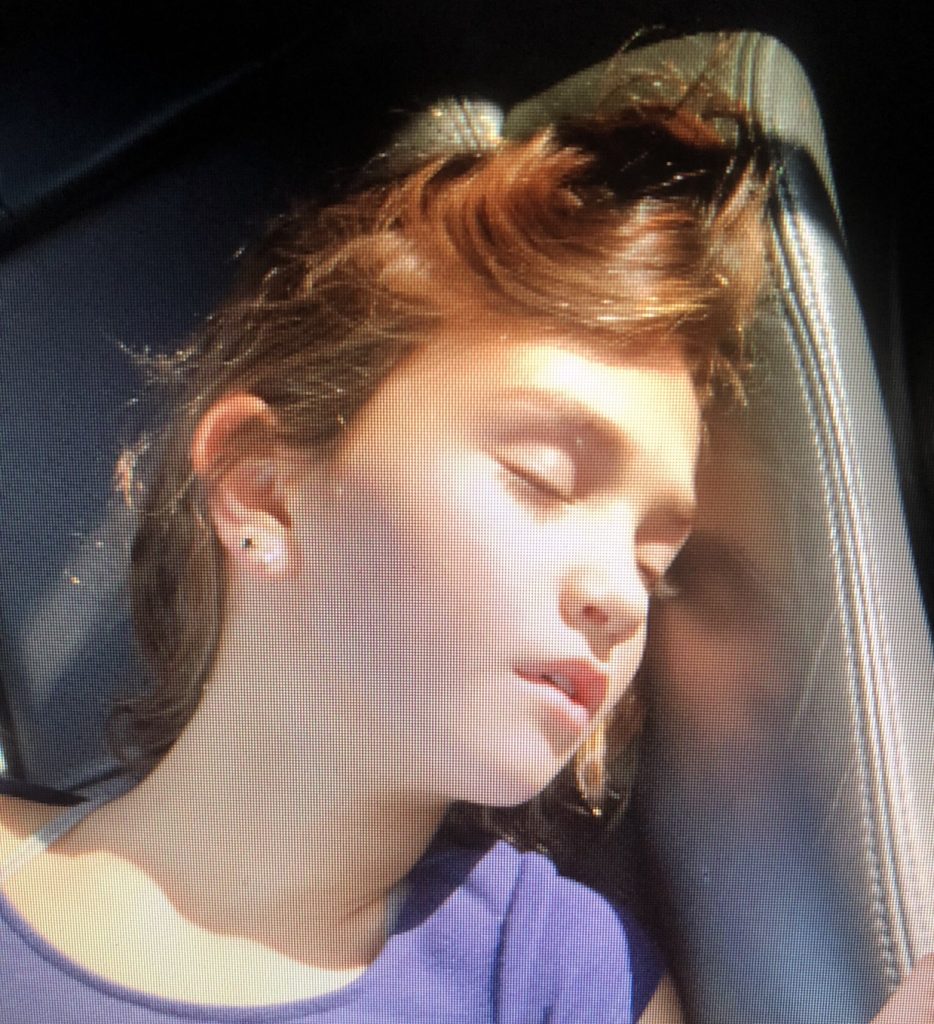 mouth breathing