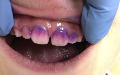6 Common Tooth Brushing Mistakes Parents Make  font?
