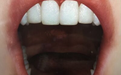 Your Mouth, Is The Portal Into Your Body