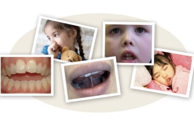 10 Reasons to See an Oral Myofunctional Therapist