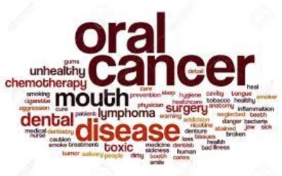 Oral Cancer: A Silent Threat