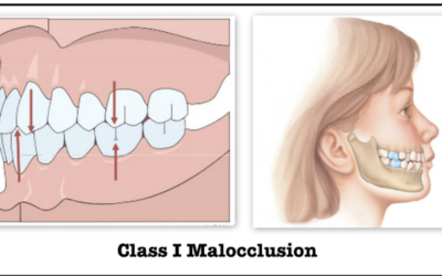 What is Airway orthodontics?