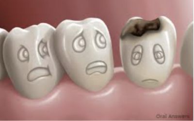 Can Tooth Decay Be Reversed