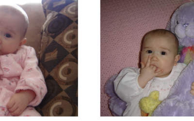 Thumb Sucking, Finger Sucking and Pacifier Habits 