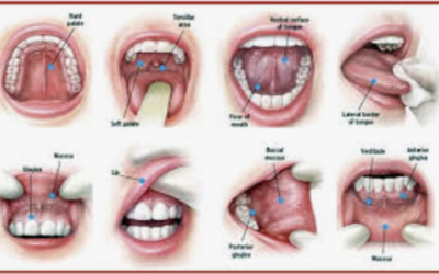 Recognizing the Warning Signs of Oral Cancer