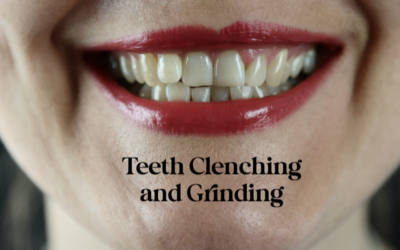 Teeth grinding / Clenching